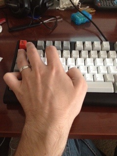 wonky hand